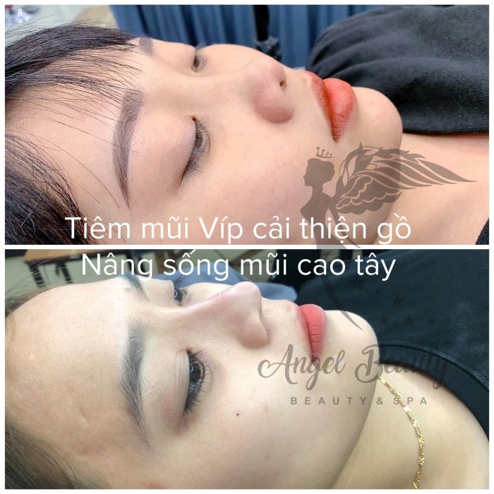 Angel Beauty hình ảnh 1