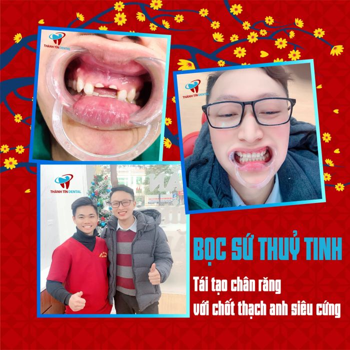 Hình ảnh thực tế tại Nha khoa Thành Tín - Bác sĩ Công (Ảnh 2)