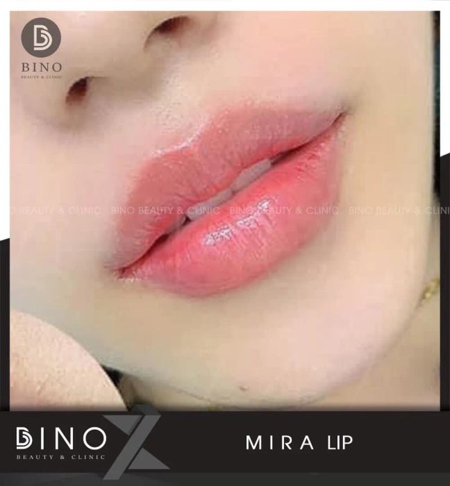 Bino Beauty & Clinic hình ảnh 2