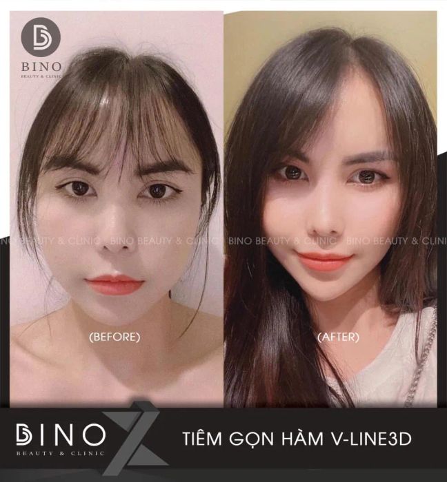 Bino Beauty & Clinic hình ảnh 1