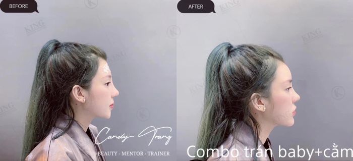 Unisex Beauty hình ảnh 1