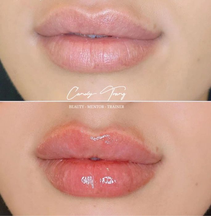 Unisex Beauty hình ảnh 2