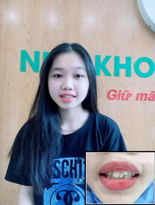 Hình ảnh đội ngũ bác sĩ chuyên nghiệp tại Nha khoa Bảo Châu