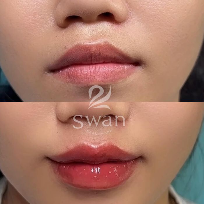 Không gian trị liệu sang trọng tại Swan Beauty Spa