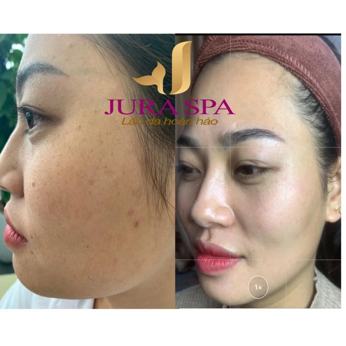 Jura Spa ảnh 3