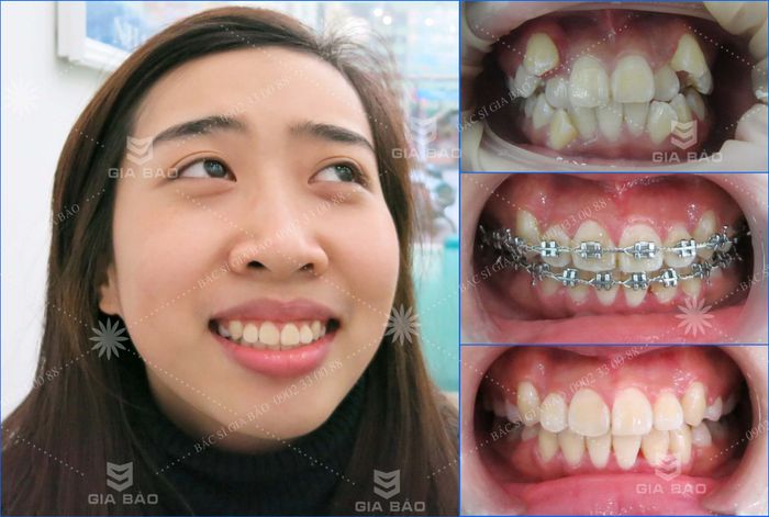 Hình ảnh phòng khám Nha Khoa Gia Bảo