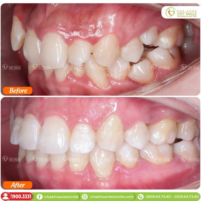 Hình ảnh phòng khám hiện đại tại Nha Khoa Việt Smile