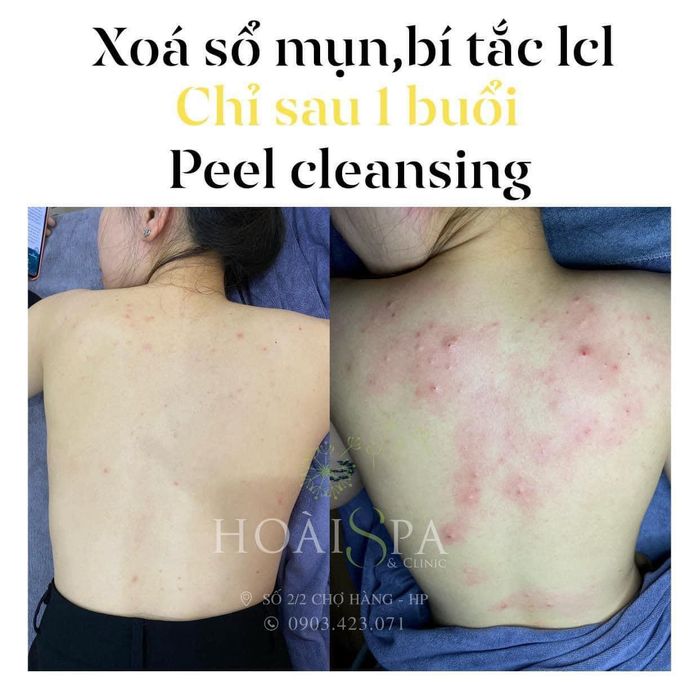 Hình ảnh thư giãn đẳng cấp tại Hoài Spa & Clinic
