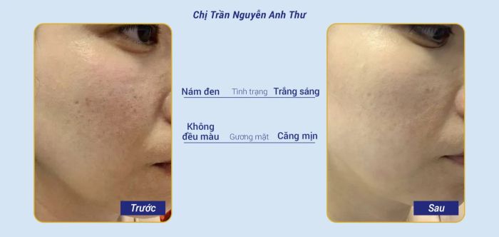 Thẩm Mỹ Viện Ngọc Dung ảnh 2