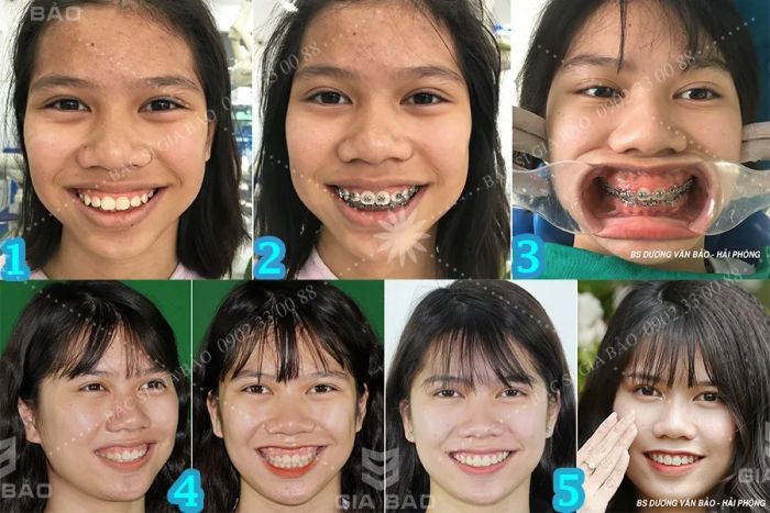 Hình ảnh đội ngũ bác sĩ chuyên môn tại Nha khoa Gia Bảo