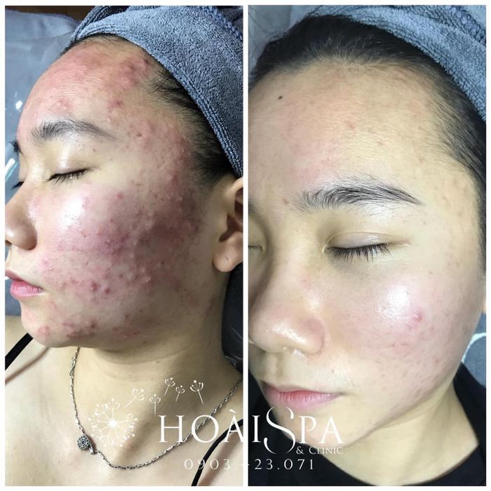 Hình ảnh không gian sang trọng tại Hoài Spa & Clinic