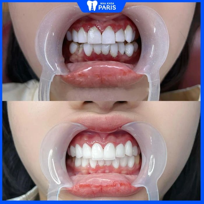 Hệ thống trang thiết bị hiện đại tại Nha Khoa Paris
