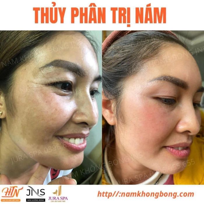 Jura Spa ảnh 2