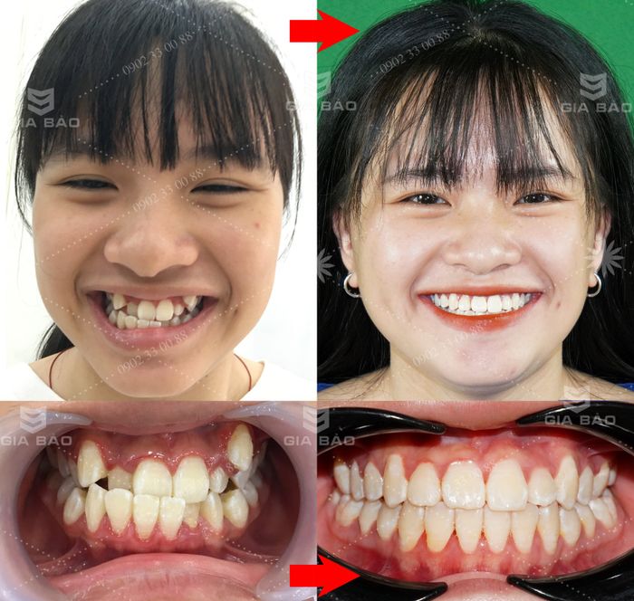 Khám phá không gian hiện đại tại Nha khoa Gia Bảo qua ảnh 2 - nơi kết hợp công nghệ tiên tiến và phong cách phục vụ tinh tế.
