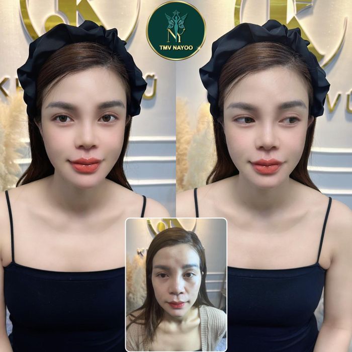 Hình ảnh phòng trị liệu cao cấp tại Nayoo Spa