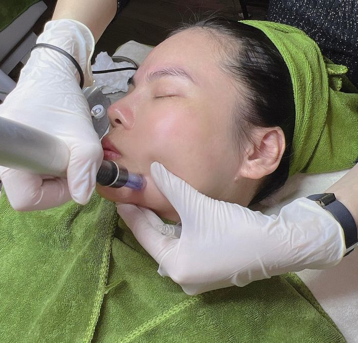 Phòng điều trị da cao cấp tại Ngọc Yến Beauty & Spa