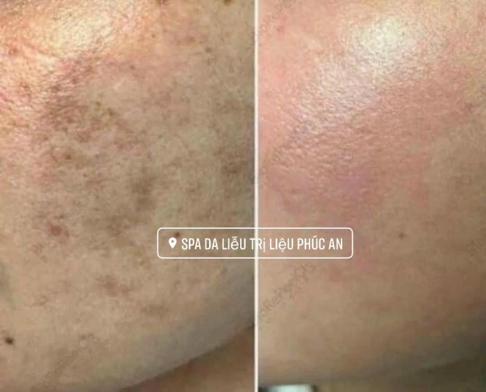 Spa Da Liễu Trị Liệu Phúc An ảnh 2