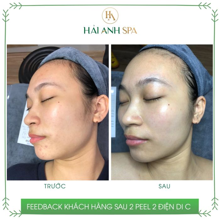 Phòng chăm sóc da cao cấp tại Spa Hải Anh