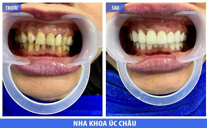 Không gian điều trị sang trọng tại Nha Khoa Úc Châu