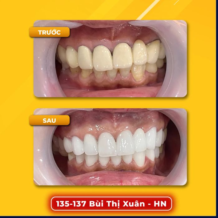 Hình ảnh phòng khám Nha Khoa Dencos Luxury