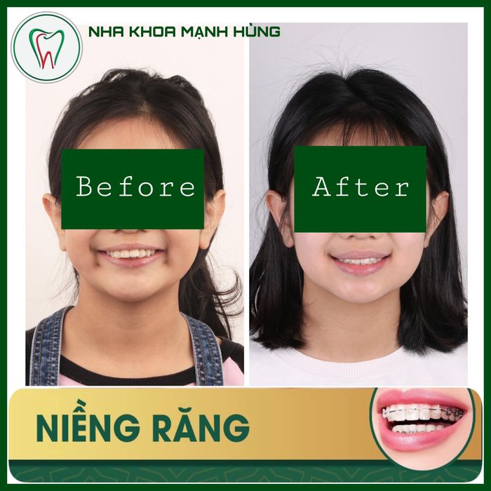 Hình ảnh 2 tại Nha Khoa Mạnh Hùng - Quy trình vô trùng nghiêm ngặt cùng đội ngũ bác sĩ giàu kinh nghiệm, luôn đặt sự hài lòng và sức khỏe của khách hàng lên hàng đầu.
