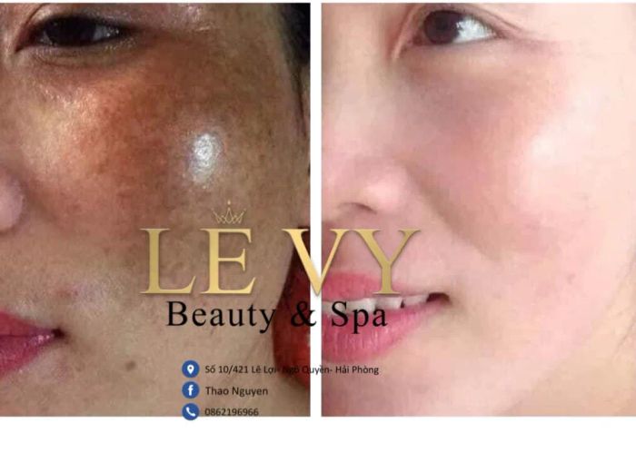 Lê Vy Beauty Spa ảnh 1
