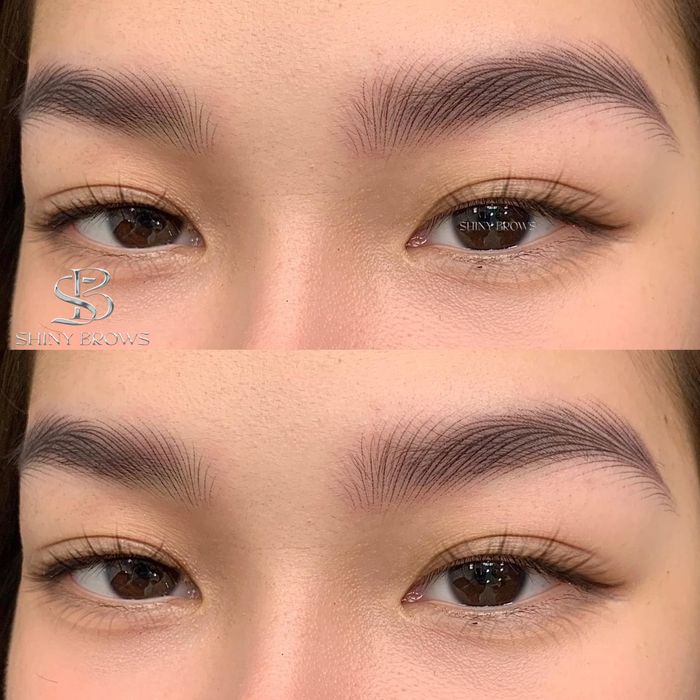Hình ảnh thực tế tại Hoang Anh Beauty
