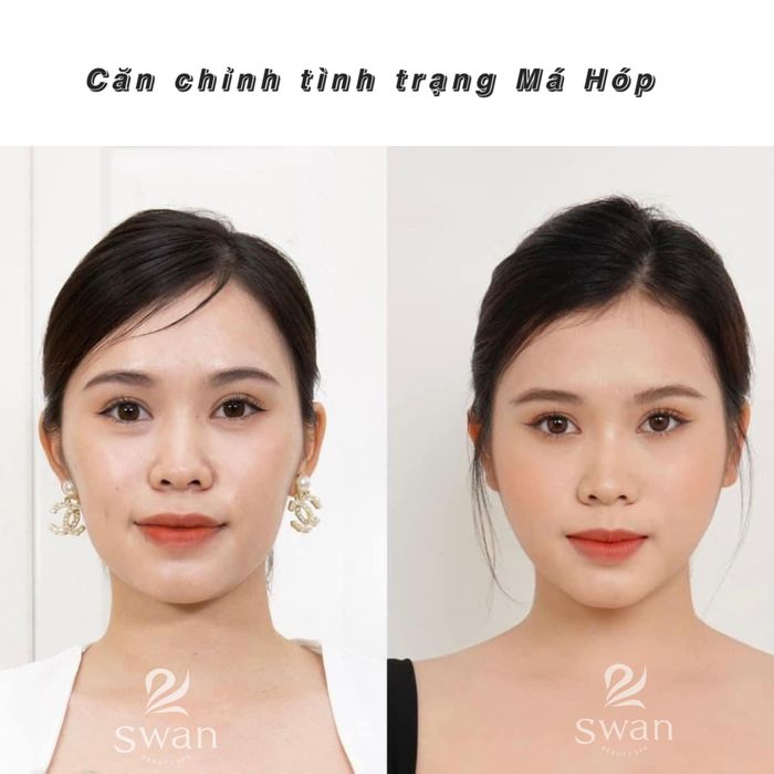 Hình ảnh phòng điều trị cao cấp tại Swan Beauty Spa