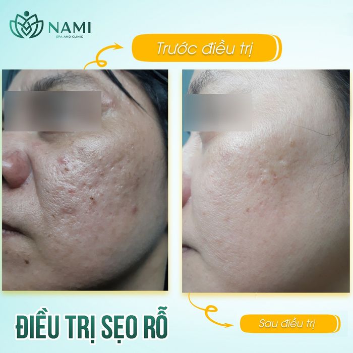 Phòng điều trị da cao cấp tại Nami Spa Beauty & Clinic