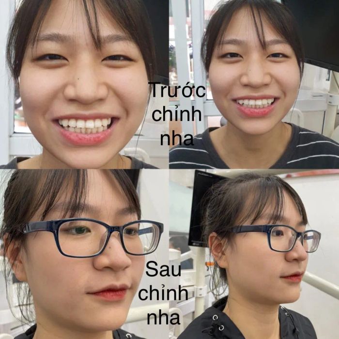 Hình ảnh đội ngũ bác sĩ chuyên môn cao tại Nha khoa Hoàn Kiếm