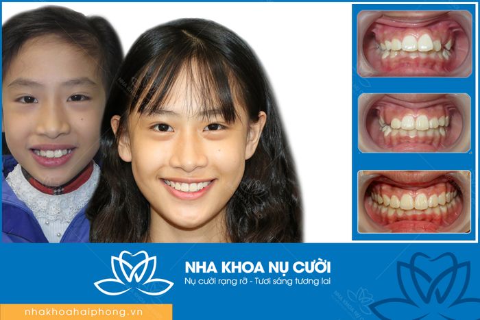 Hình ảnh thực tế Nha Khoa Nụ Cười Hải Phòng