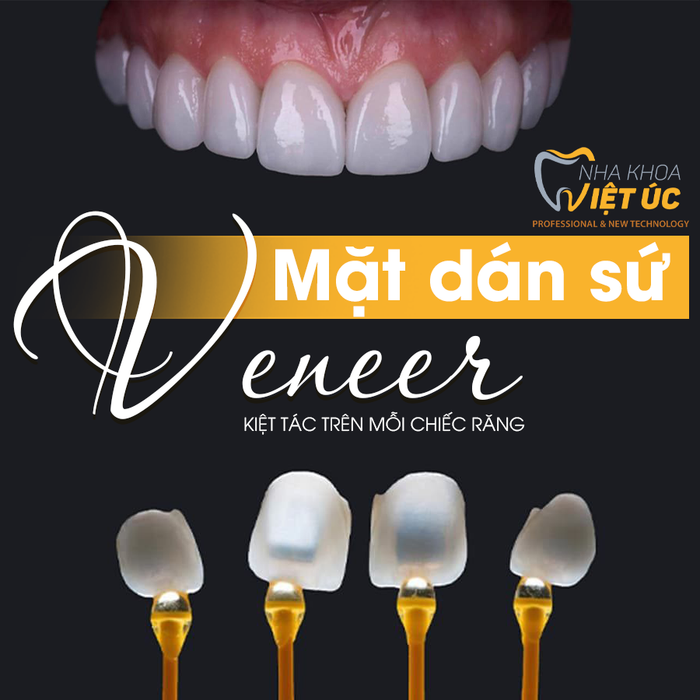 Góc nhìn thực tế tại Nha khoa Việt Úc – Hình ảnh số 1