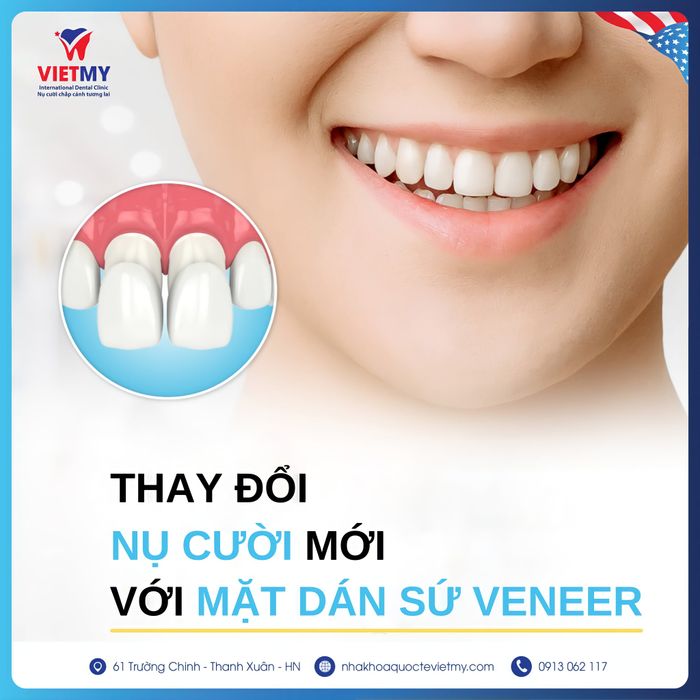 Hình ảnh thứ hai từ Nha khoa Quốc tế Việt Mỹ – Không gian hiện đại, dịch vụ chuyên sâu