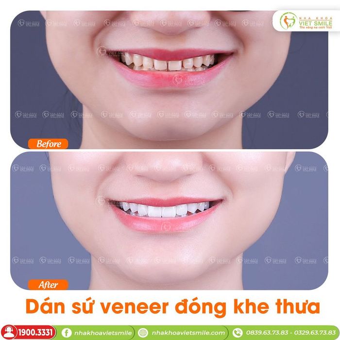 Hình ảnh thực tế tại Nha Khoa VIET SMILE – Cái nhìn đầu tiên về chất lượng và sự chuyên nghiệp