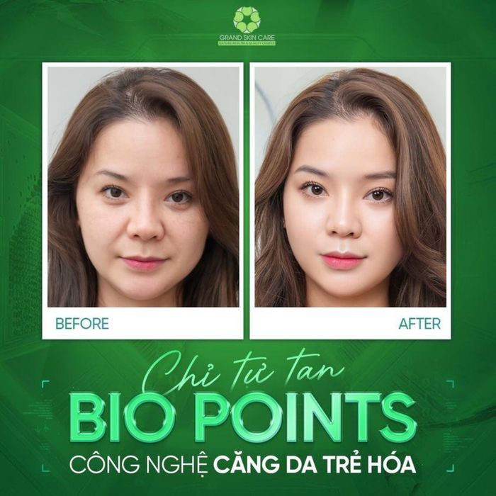 Hình ảnh không gian trị liệu cao cấp tại Grand Skin Care