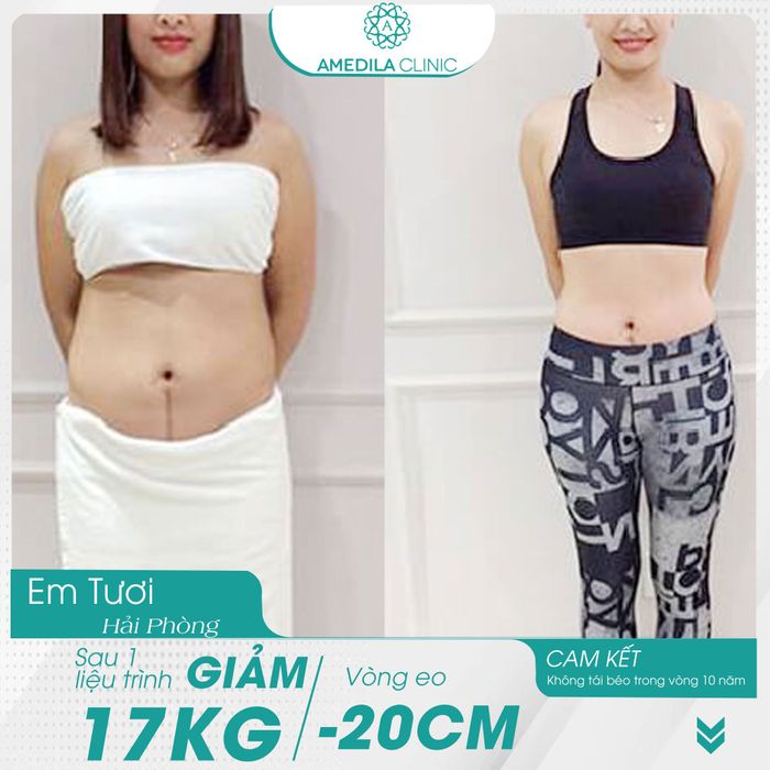Hình ảnh khu vực điều trị cao cấp tại Viện Thẩm Mỹ Pháp Việt