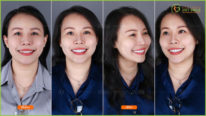 Khám phá không gian hiện đại tại Nha Khoa VIET SMILE qua hình ảnh thứ hai