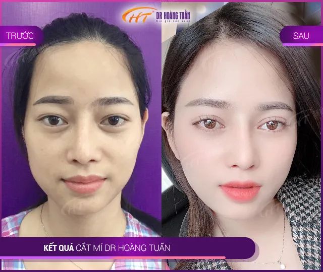 Hình ảnh Thẩm Mỹ Dr Hoàng Tuấn (1)