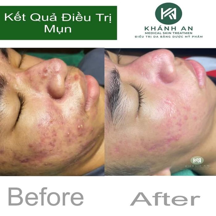 Khánh An Spa - Khoảnh khắc 2: Góc nhìn nghệ thuật về phòng trị liệu cao cấp, nơi ánh sáng vàng ấm áp hòa quyện cùng thiết bị công nghệ hiện đại.