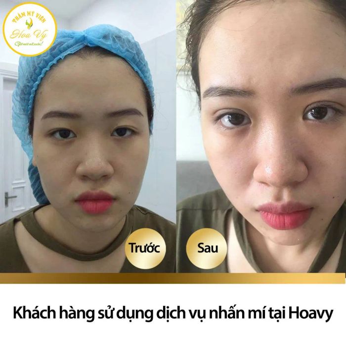 Hình ảnh Thẩm Mỹ Viện Hoa Vy (2)