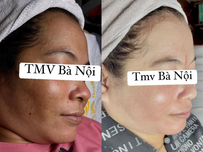 Hình ảnh ấn tượng từ Thẩm mỹ viện Bà Nội 2 - nơi lưu giữ những khoảnh khắc đẹp đẽ của sự thay đổi và tự tin.