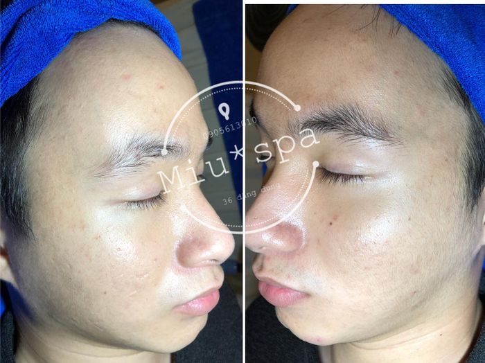 Miu Spa - Khoảnh khắc 2: Góc nhìn nghệ thuật về phòng trị liệu cao cấp, nơi công nghệ hiện đại hòa quyện cùng không gian thư giãn đầy cảm hứng.