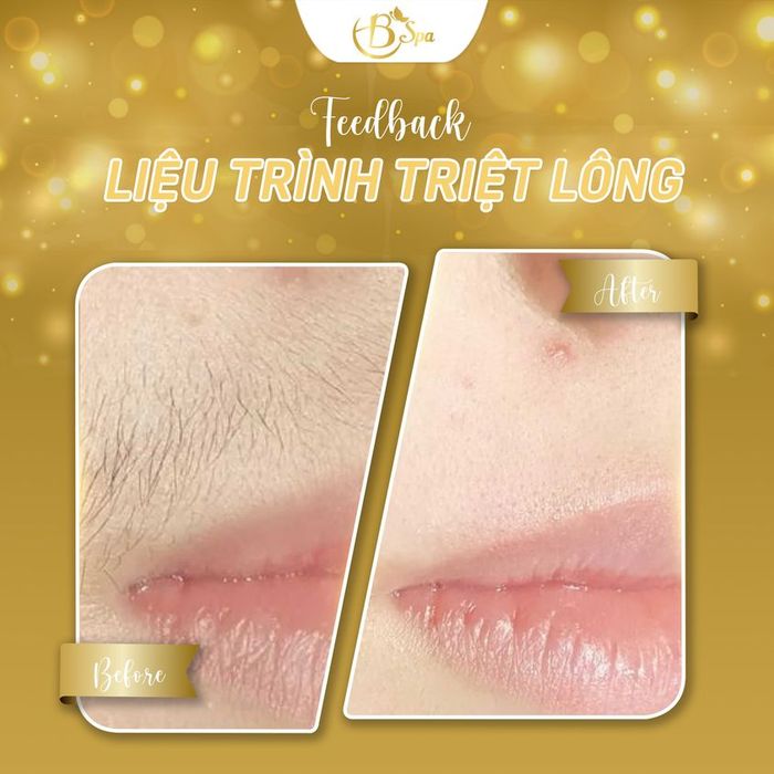 Hình ảnh ấn tượng về các liệu trình chăm sóc da tại B Spa