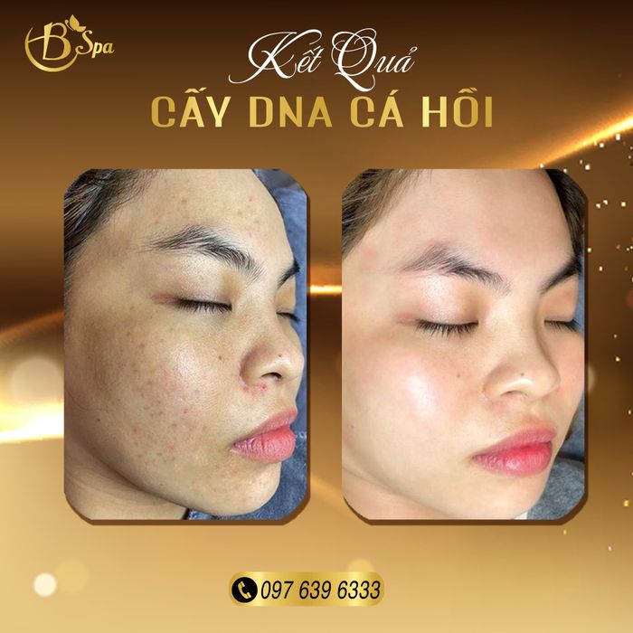 Không gian sang trọng và dịch vụ đẳng cấp tại B Spa