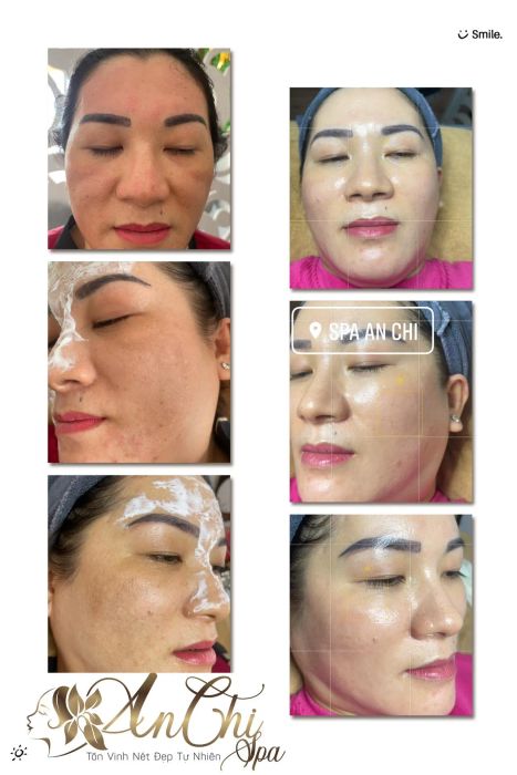 Hình ảnh không gian chăm sóc da tại An Chi Spa