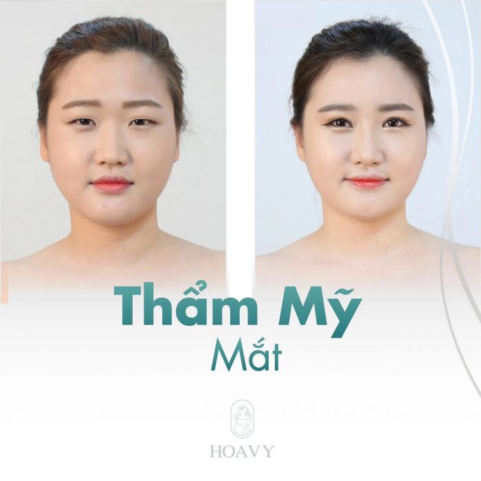 Hình ảnh Thẩm Mỹ Viện Hoa Vy (1)