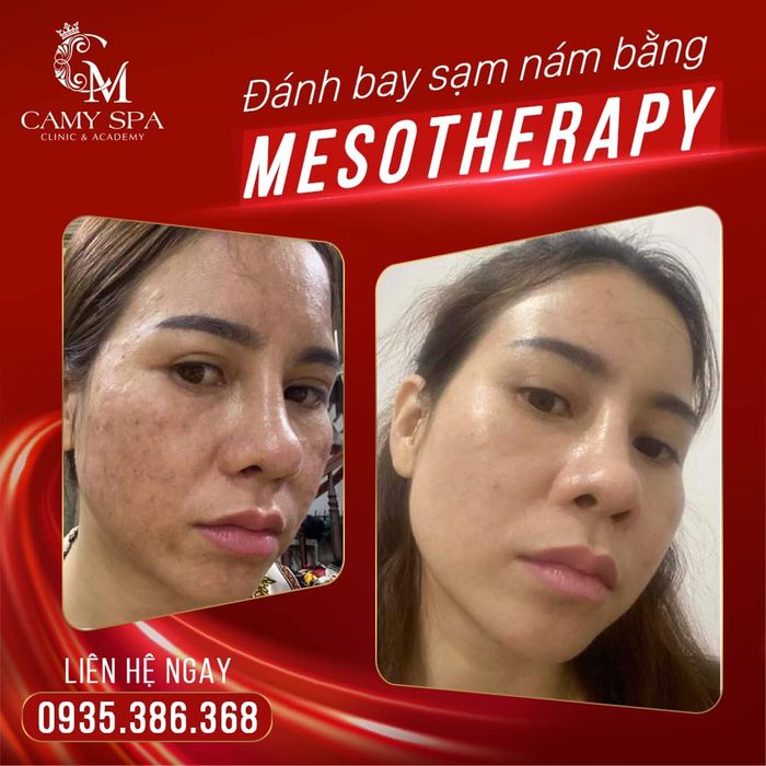 Trải nghiệm dịch vụ cao cấp tại Thẩm Mỹ Viện CAMY Clinic - Ảnh 3