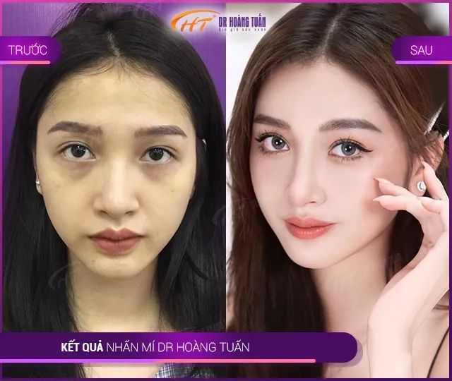 Hình ảnh Thẩm Mỹ Dr Hoàng Tuấn (2)