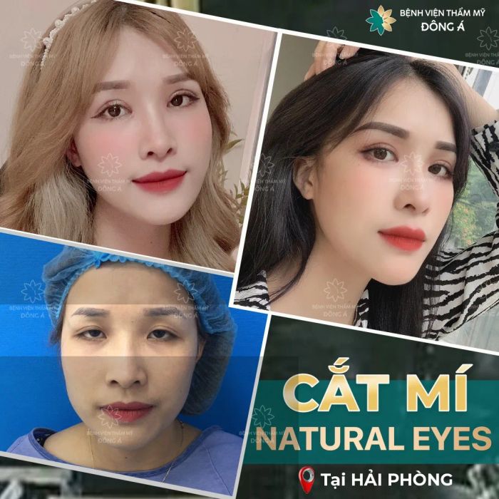 Hình ảnh Thẩm Mỹ Viện Đông Á Hải Phòng