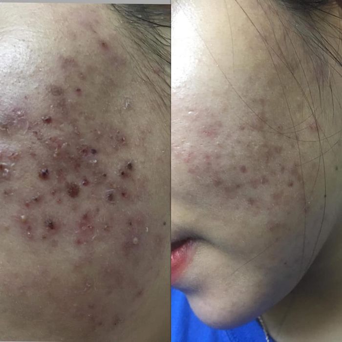 Yuki Spa - Khoảnh khắc đẹp 1: Không gian tinh tế với ánh sáng dịu nhẹ, nơi mỗi góc ảnh đều kể câu chuyện về sự thư thái và đẳng cấp.
